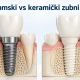 Titanijumski vs keramički zubni implanti recent post image